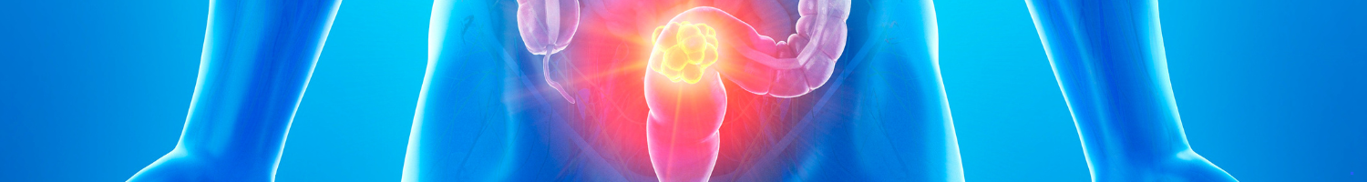 2025 EDW Multidisciplinary Rectal Tumor Board (RSS) Banner